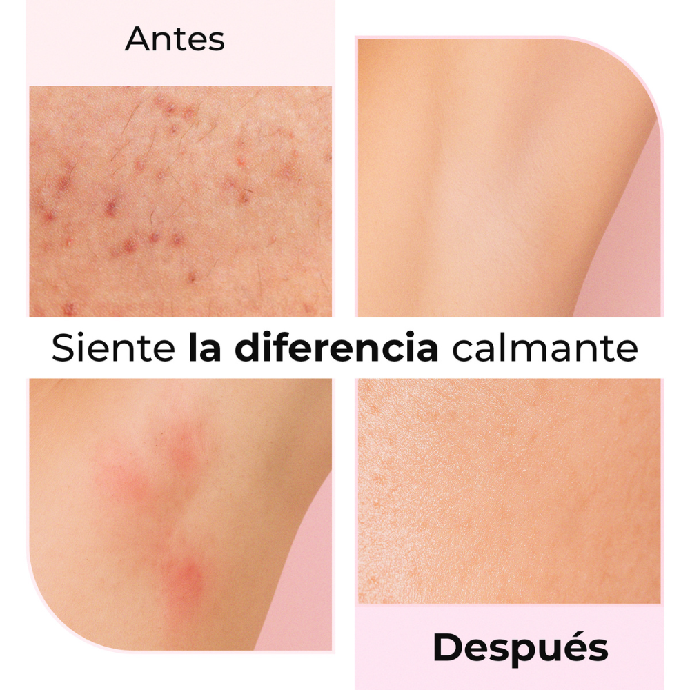 Antes y después de usar Silky Balloon – Reducción visible de irritaciones tras el afeitado.